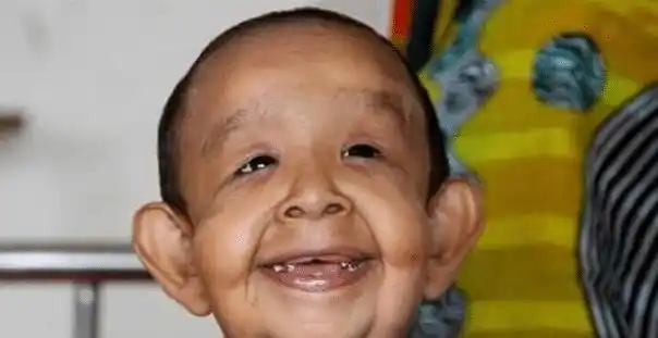 印尼哥哥"强娶"亲妹妹,俩人孩子出生后长这样,网友:自食恶果_畸形儿