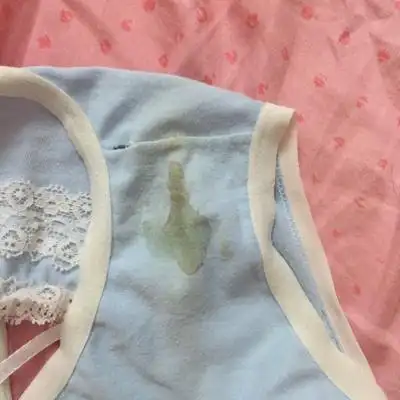 刚刚发现内裤有这个,好害怕,宝宝有没有事