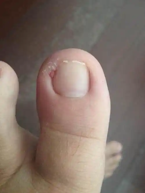 步骤二:加一小勺盐,加5滴红花油,调匀.