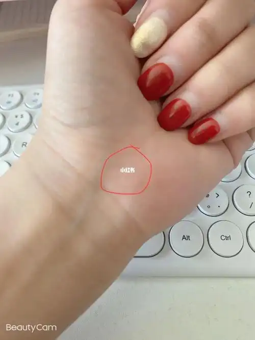 原来朱砂痣是真实存在的…这个小红点长了几年了 起初我以为是不小心