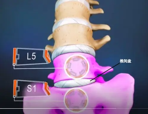 请高人翻译这段ct报告