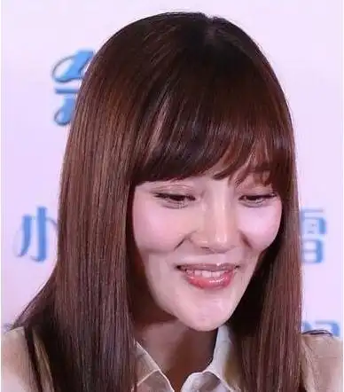 李小璐整容后遗症鼻子变形