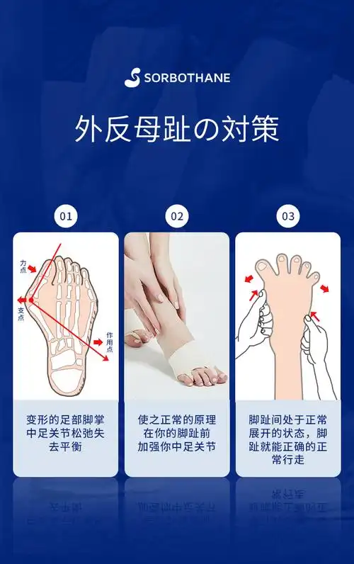 大脚趾 小脚趾矫正-薄型(左脚) s【图片 价格 品牌 报价】-京东