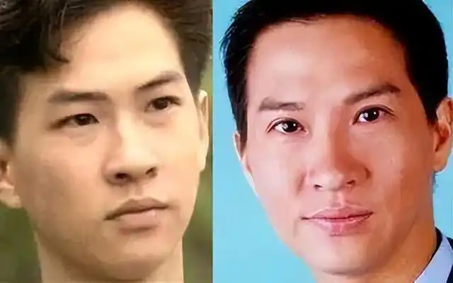 通过做双眼皮明显提高颜值的男明星,魅力十足,有些还成为了影帝