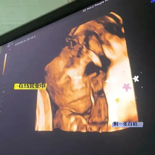 双胞胎|四维_四维彩超_双胞胎_糖耐_母婴_孕产经验