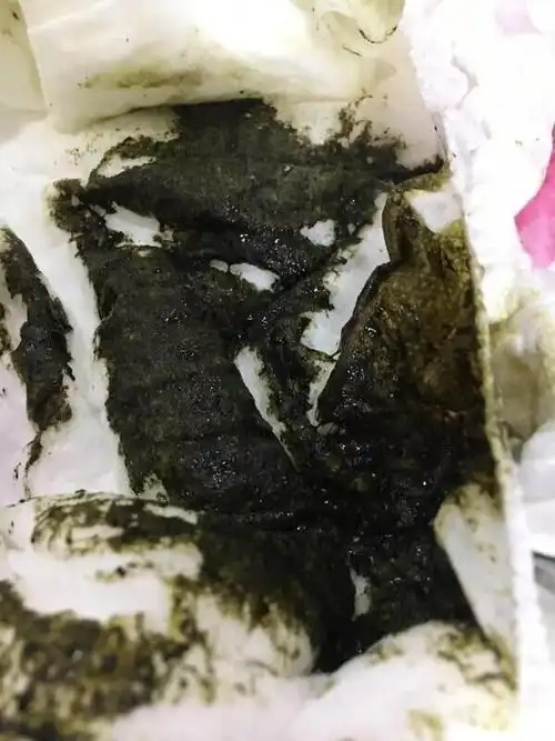 肝硬化拉黑便得拉几天?-图片大观-奇异网