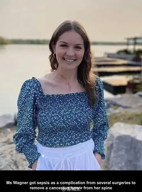 加拿大26岁女子发烧以为流感结果是败血症每年40w人因此丧命