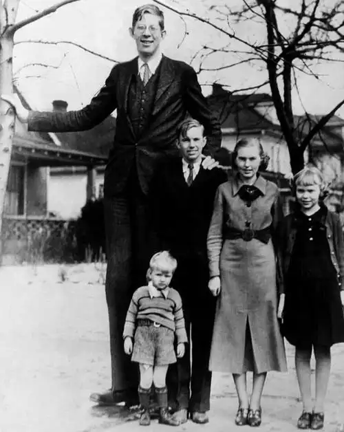 据吉尼斯世界纪录,世界上身高最高的人,是在幼年时得了巨人症的罗伯特