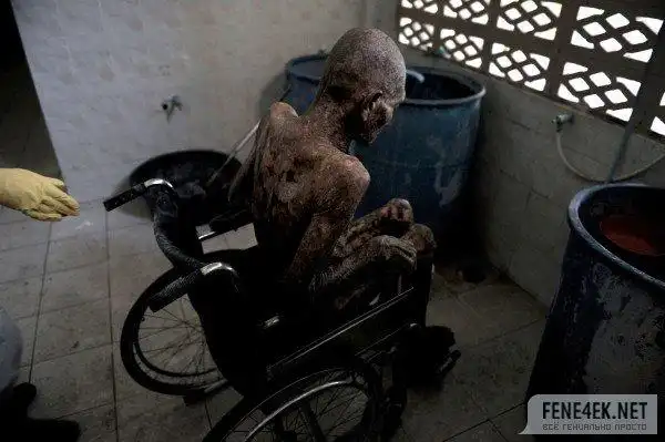 寺庙里的晚期艾滋病人(触目惊心)