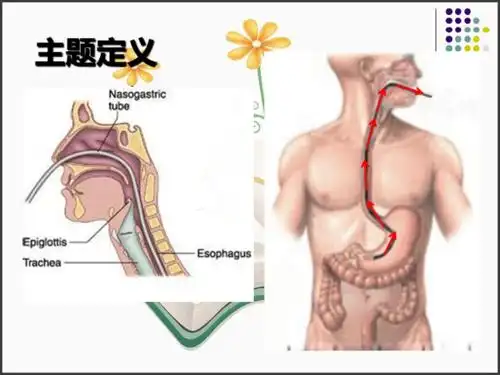 提高患者胃肠减压期间舒适度2