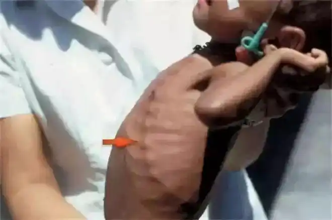 鸡大胸和鸡胸肉是鸡身上的同一部位,只是叫法不同鸡胸肉是在胸部里侧