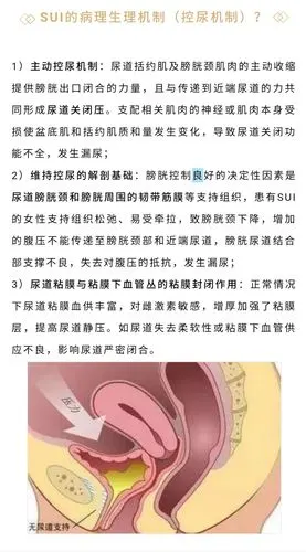 全面了解压力性尿失禁_压力性尿失禁_介绍_发病原因_检查_治疗方式