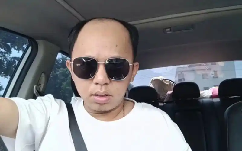 戴假发真的很麻烦吗,秃头老男人的日常