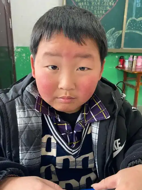 冻得满脸通红满手冻疮鹤峰的孩子今年还要继续这样吗