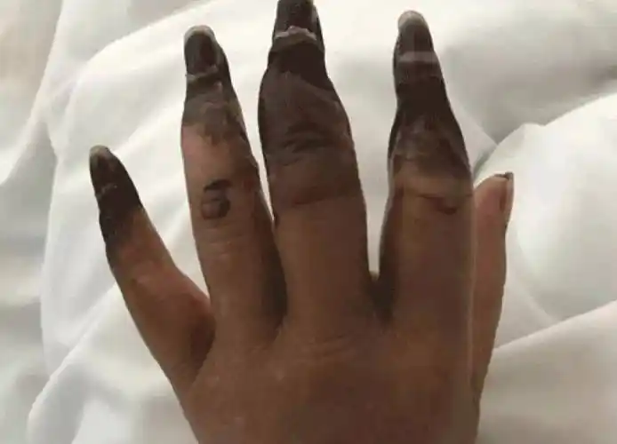 手为什么会黑(手指纹里面黑黑的洗不掉)-好多多分享网