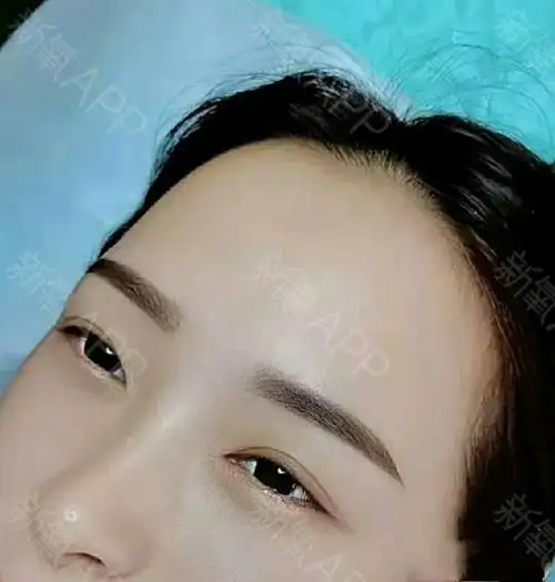 半永久纹眉好不好_效果图_氧气3c11s半永久纹眉术后第1天_新氧美容