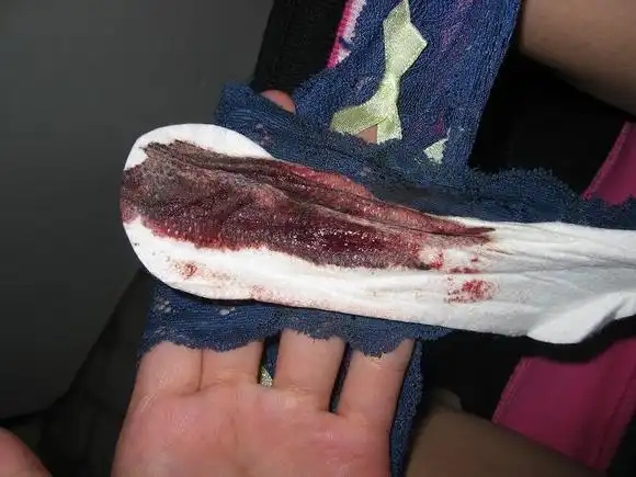 女生大姨妈血崩流血,女生大姨妈血崩月经-图片大观-奇异网