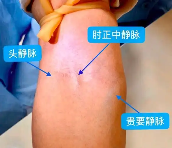 采血管的抽血顺序,到底谁先谁后?看看有哪些可能被忽略的问题!