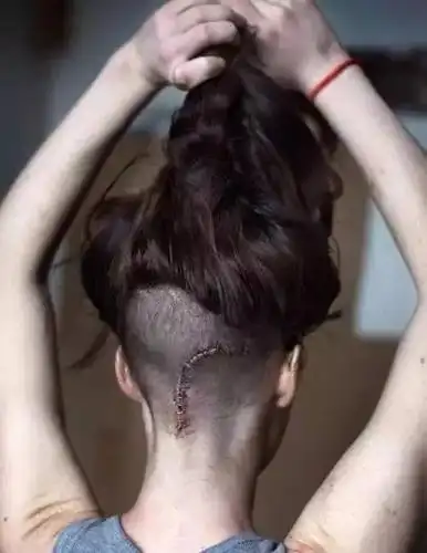 一位加拿大女孩吸毒的恐怖过程看完之后你还有好奇心吗