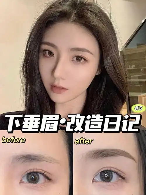 眉貌改造跟下垂眉say拜拜