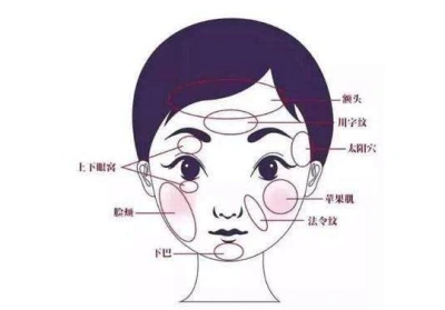 济南脂肪填充额头大概要多少钱受什么因素影响