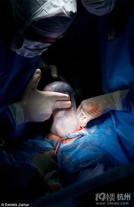 摄影师记录妈妈们分娩