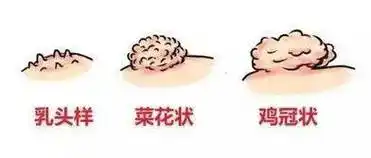 丁丁上长小疙瘩红点怀疑是出现性病了吗