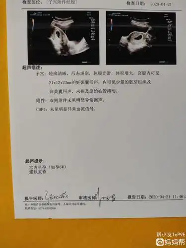 作善降祥!怀孕能分辨男女的症状"千辛万苦"-第1张图片-贺发网