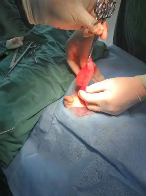 孩子的"蛋蛋"一下子就减轻了许多