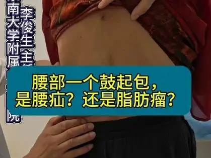 腰部包块,是疝气还是脂肪瘤?