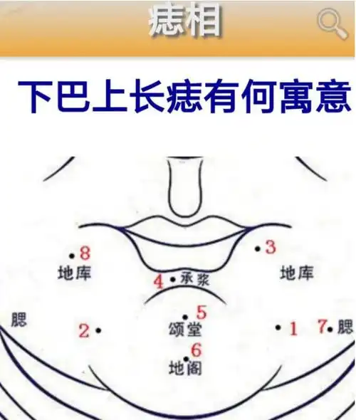 痣相下巴上有痣究竟有何寓意