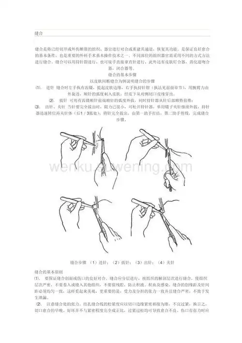 外科缝合手法图文讲解