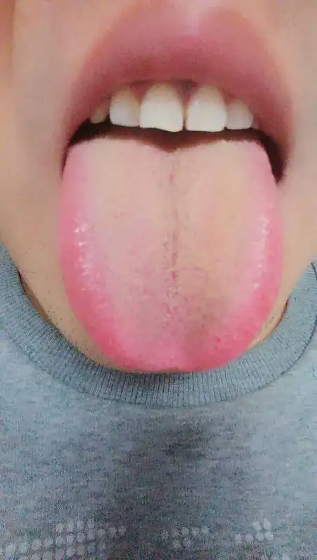 舌苔黄厚,有时候刷牙刻意去刷,刷完还会有很多,身体没有什么不舒服