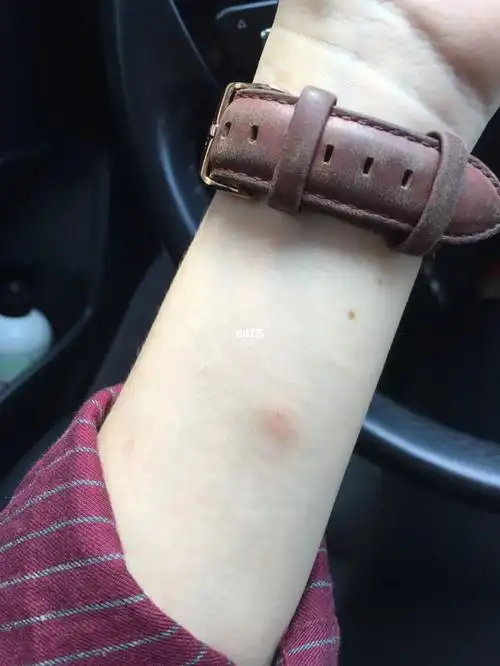 小红薯的小姐姐们帮我看看这样子72小时了,是不是阴性