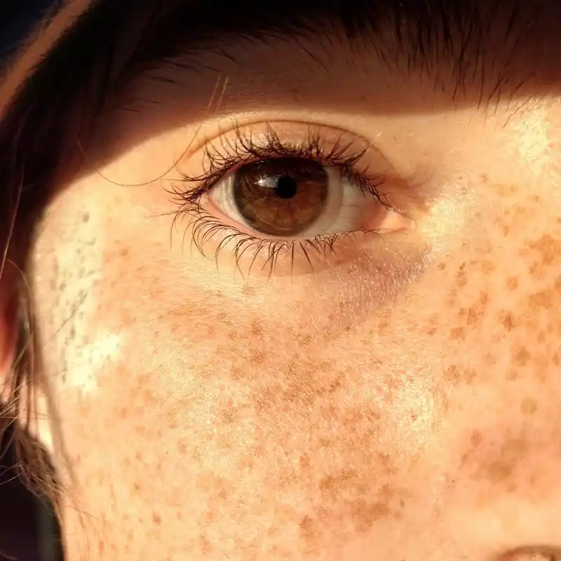 黄褐斑,这一肌肤的"顽疾",一直以来都是众多爱美人士心中的痛.