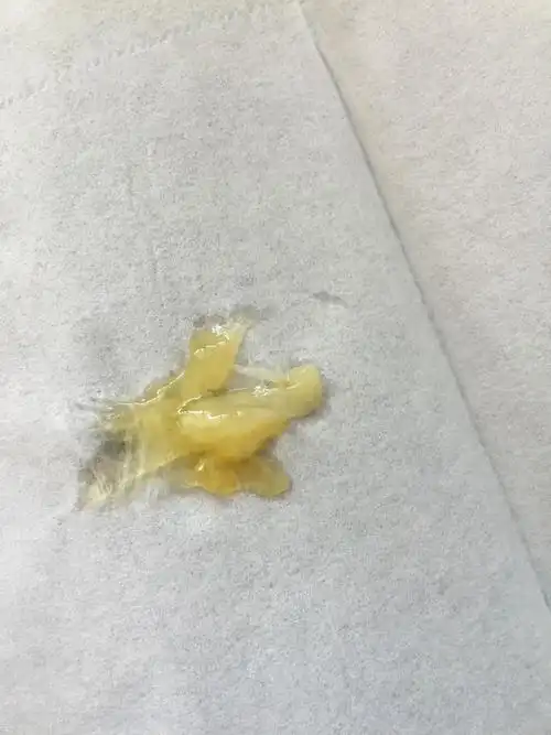 鼻涕透明粘稠,还有白色的,我没有鼻炎也没感冒,好好