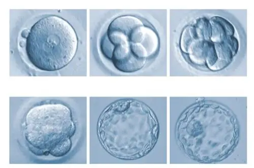 一分钟了解试管婴儿囊胚的等级划分