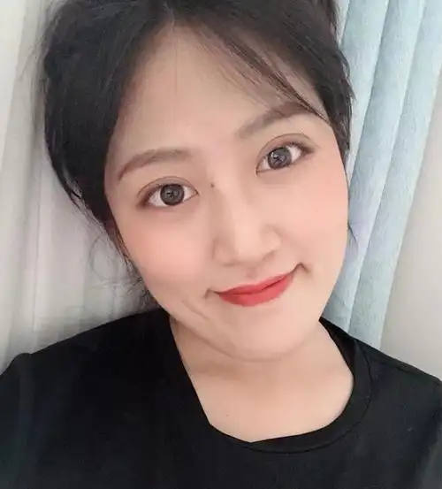 双眼皮女生别高兴太早,这些"残缺型"双眼皮,没有单眼皮好看