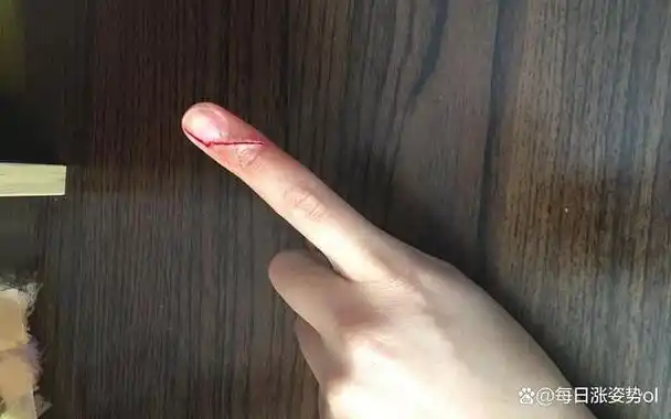 手指被纸片割破比被刀割伤更疼,这是为什么呢?