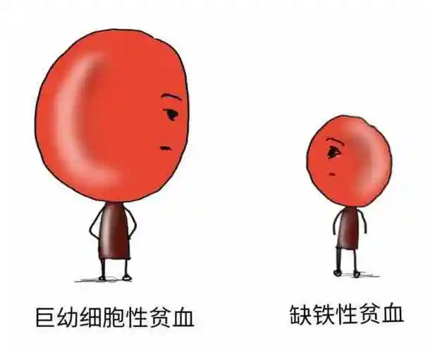 长期素食,小心巨幼细胞贫血_网易订阅