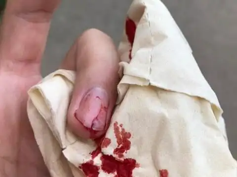 工作中的人梦见手指甲流血,预示着近期你的工作压力