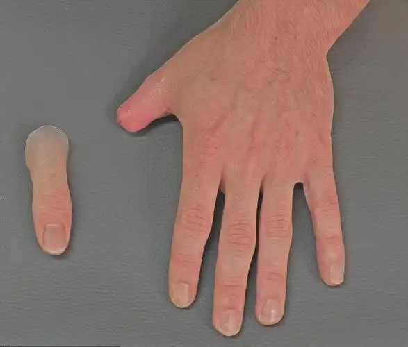 关于美容假肢手的一些介绍