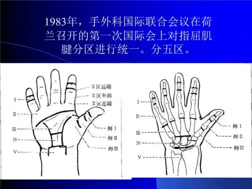 肌腱分区ppt课件.ppt