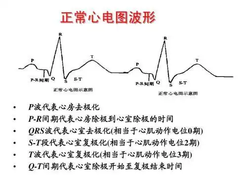 正常心电图正常心电图波形