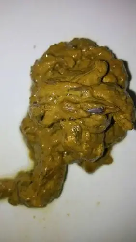 大便不成形很久,大便很细,经常放屁,有时腹泻和便秘交替,是否是直肠癌