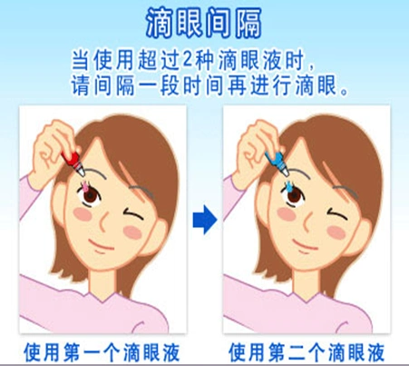 如何正确应用滴眼剂