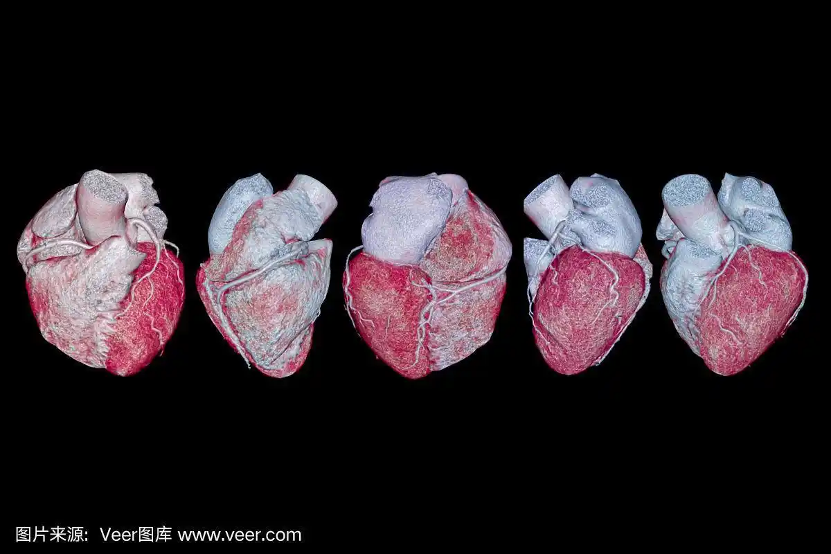 冠状动脉,三维图形,图像,人类心脏,主动脉