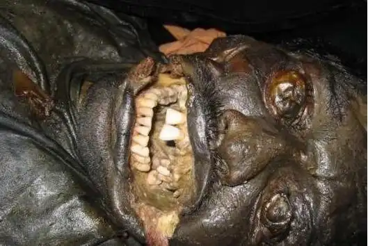 世界十大最恶心的图片:你能忍到第几张(图)