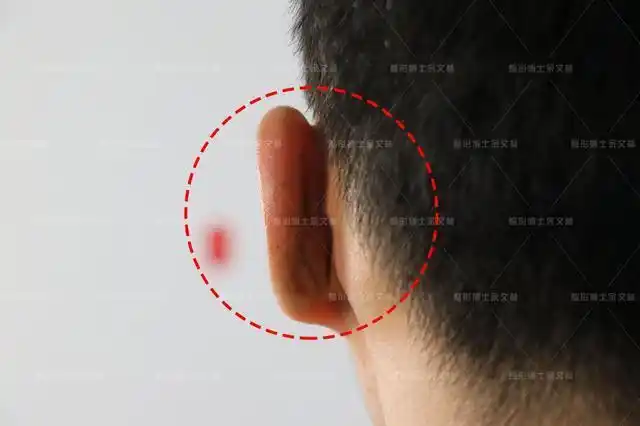 【案例分享】反骨耳是什么?耳朵反骨的人也反骨吗?_腾讯新闻