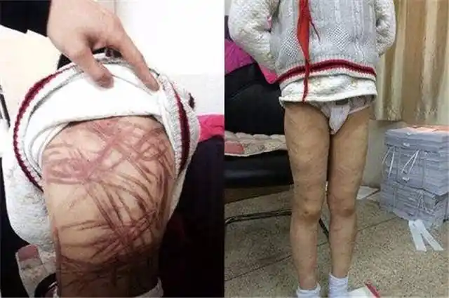 天天挨打和没挨过打的孩子,20年后,差距太明显